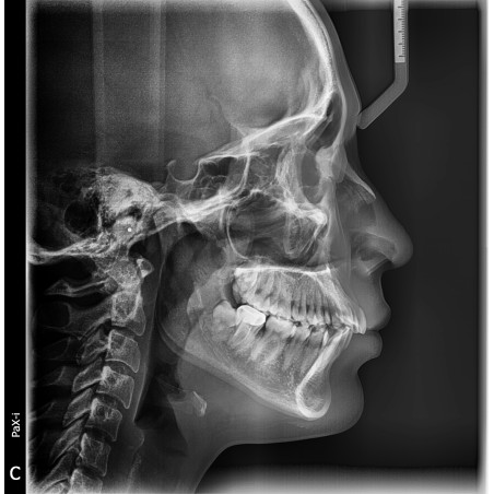 USADO Rayos X Dental Panorámico y Lateral Digital Pax i SC Vatech