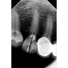 Paquete Rayos X Dental Portátil Ray98 Runyes + Radiovisiógrafo Woodpecker i-Sensor