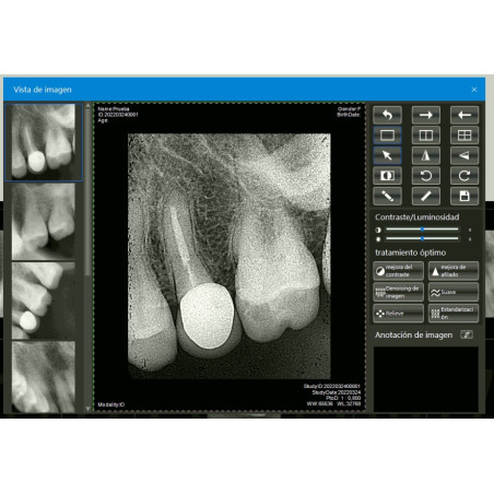 Paquete Rayos X Dental Portátil Ray98 Runyes + Radiovisiógrafo Woodpecker i-Sensor