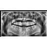 xRayos X Dental Panorámico y Lateral Digital Pax i Plus RC Vatech