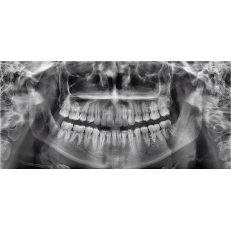 USADO Rayos X Dental Panorámico y Lateral Digital Pax i SC Vatech