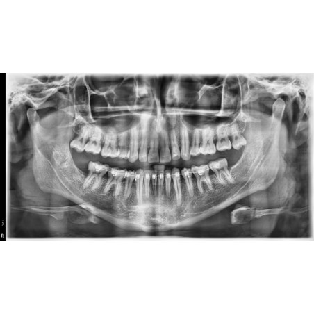 USADO Rayos X Dental Panorámico y Lateral Digital Pax i SC Vatech