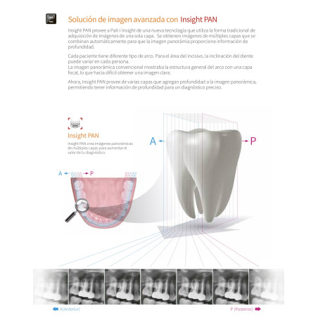 Rayos X Digital Vatech Pax-i Insight SC Panorámico y Lateral de Cráneo