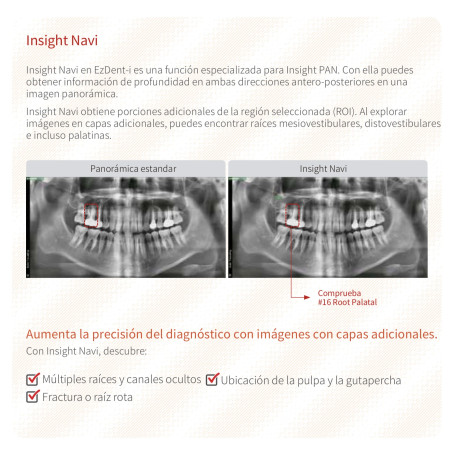 Rayos X Digital Vatech Pax-i Insight SC Panorámico y Lateral de Cráneo