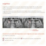 Rayos X Digital Vatech Pax-i Insight SC Panorámico y Lateral de Cráneo