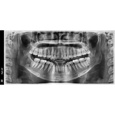 Rayos X Dental 3D Cone Beam Panorámico y Lateral Digital Vatech Smart Plus RC
