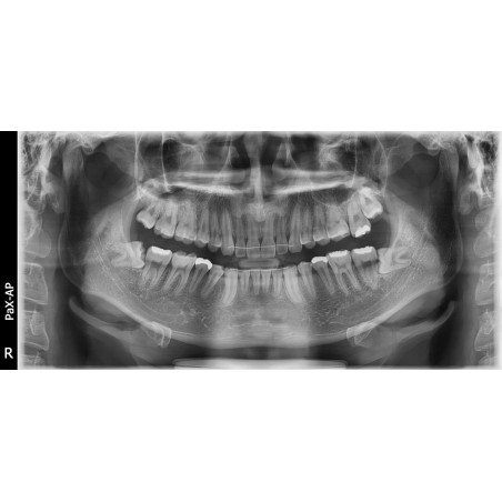 Rayos X Dental 3D Cone Beam Panorámico y Lateral Digital Vatech Smart Plus RC
