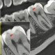 Rayos X Dental 3D Cone Beam Panorámico y Lateral Digital Vatech Green X 18 SC