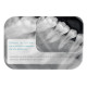 Paquete Rayos X Dental Portátil RXS + Radiovisiógrafo Eco-Sensor Anelsam - Apple Dental