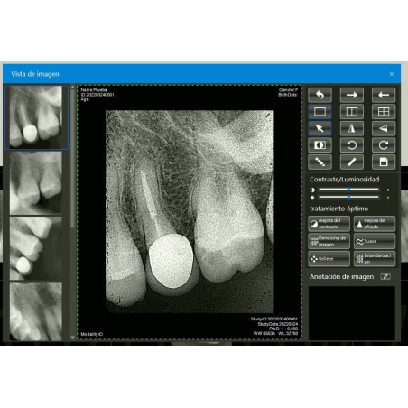 Paquete Rayos X Dental Portátil RXS + Radiovisiógrafo Woodpecker i-Sensor