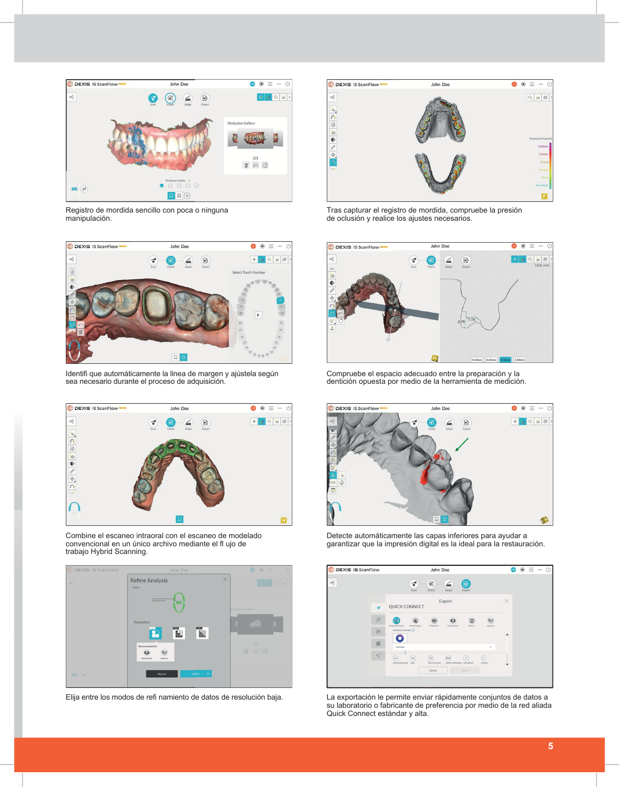 Catálogo Escáner Intraoral IS 3600 - Dexis - Página 5