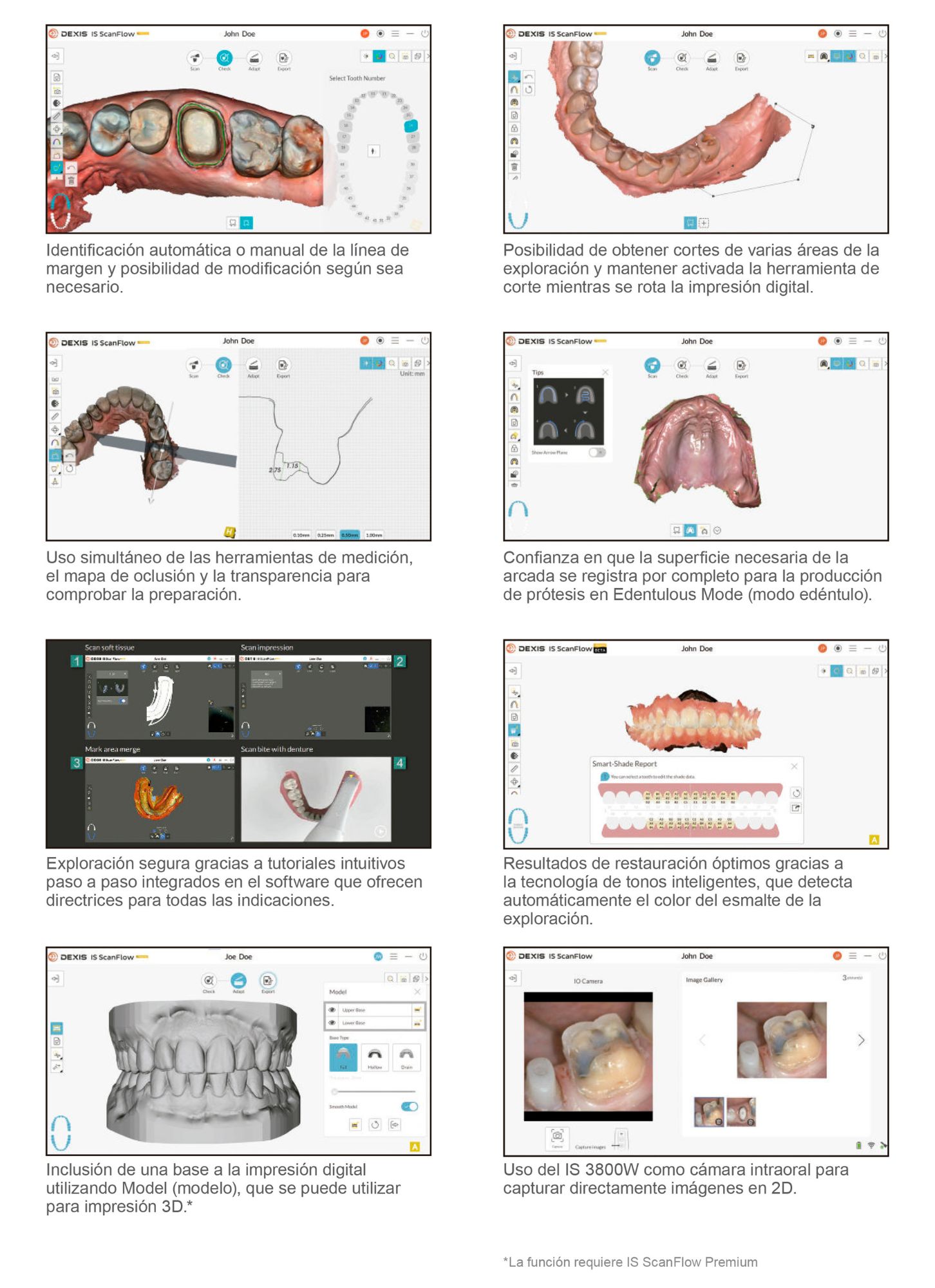 Catálogo Escáner Intraoral IS 3800 - Dexis - Página 9