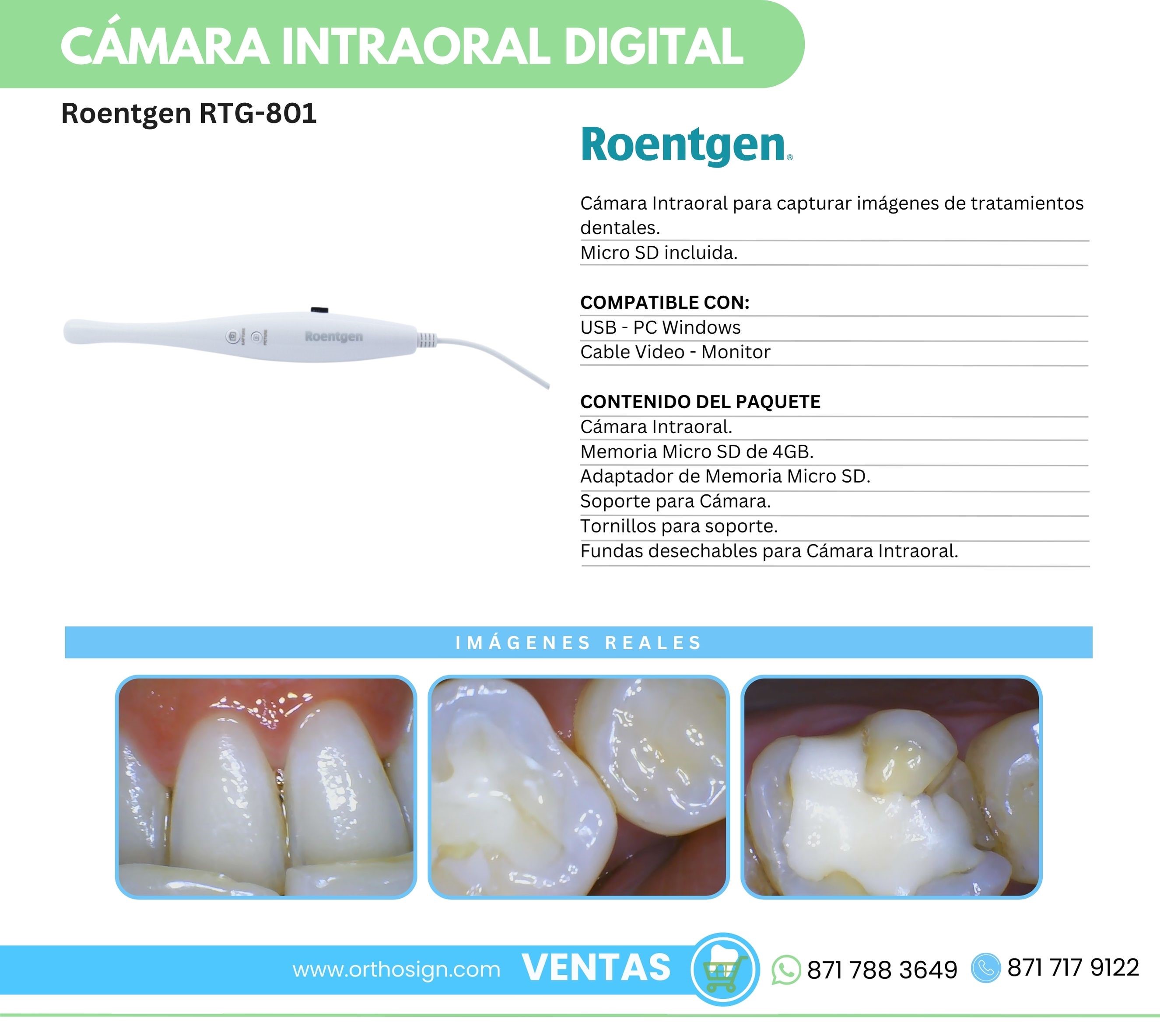 Cámara Intraoral Digital Roentgen RTG-801 Orthosign