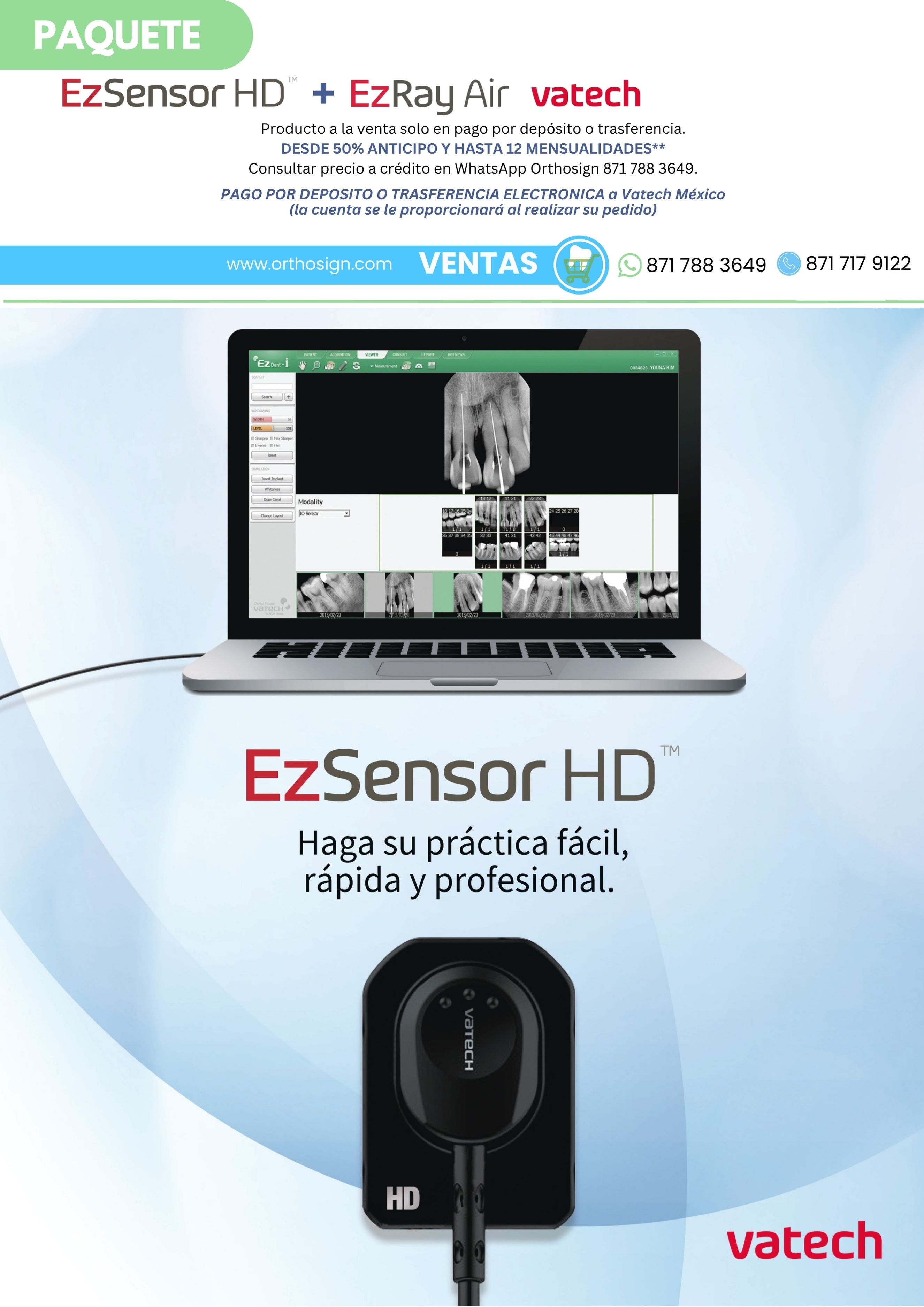 Radiovisiografo Vatech EZ Sensor HD + Rayos X Dental Portátil Ez Ray Air P Vatech Orthosign