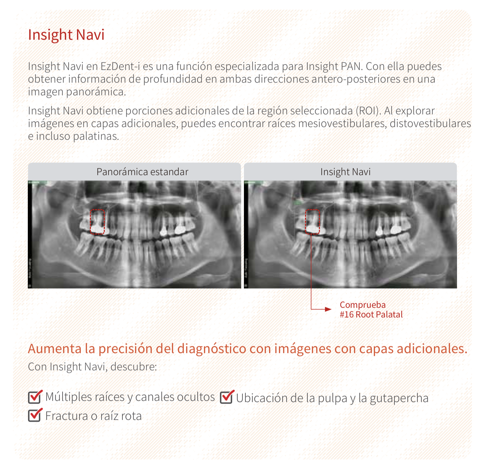 Rayos X Vatech Pax i Insight SP - Insight Navi